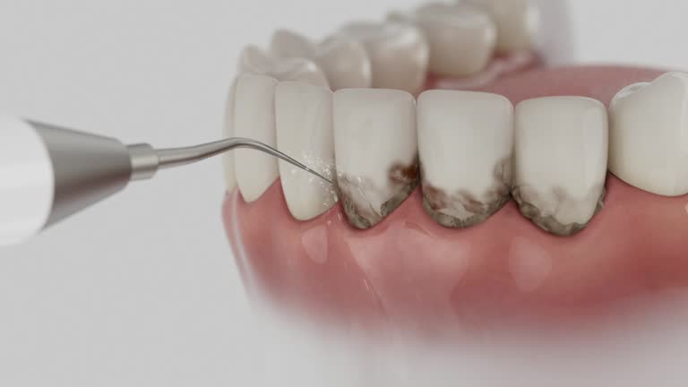 Reliable Emergency Dentist contractor in Eyota, MN by Smile Center Dentistry